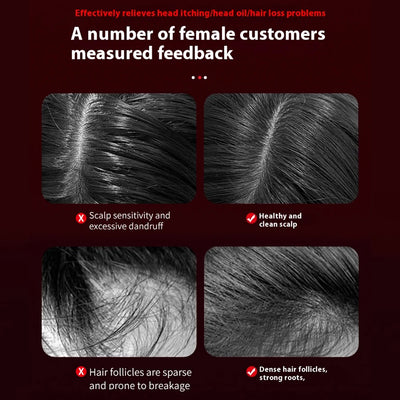 Electric Hair Regrowth Massage Brush